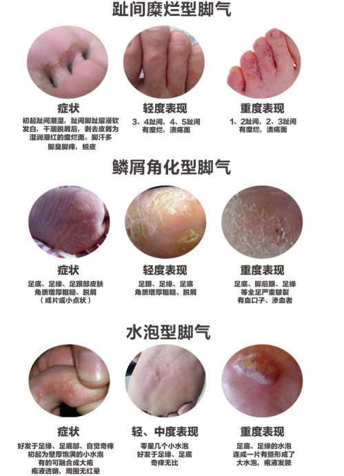辅助适用范围