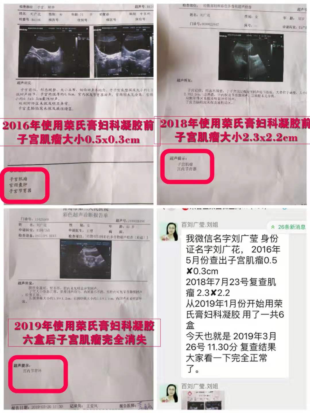 1597489156343733.jpg 子宫肌瘤.jpg