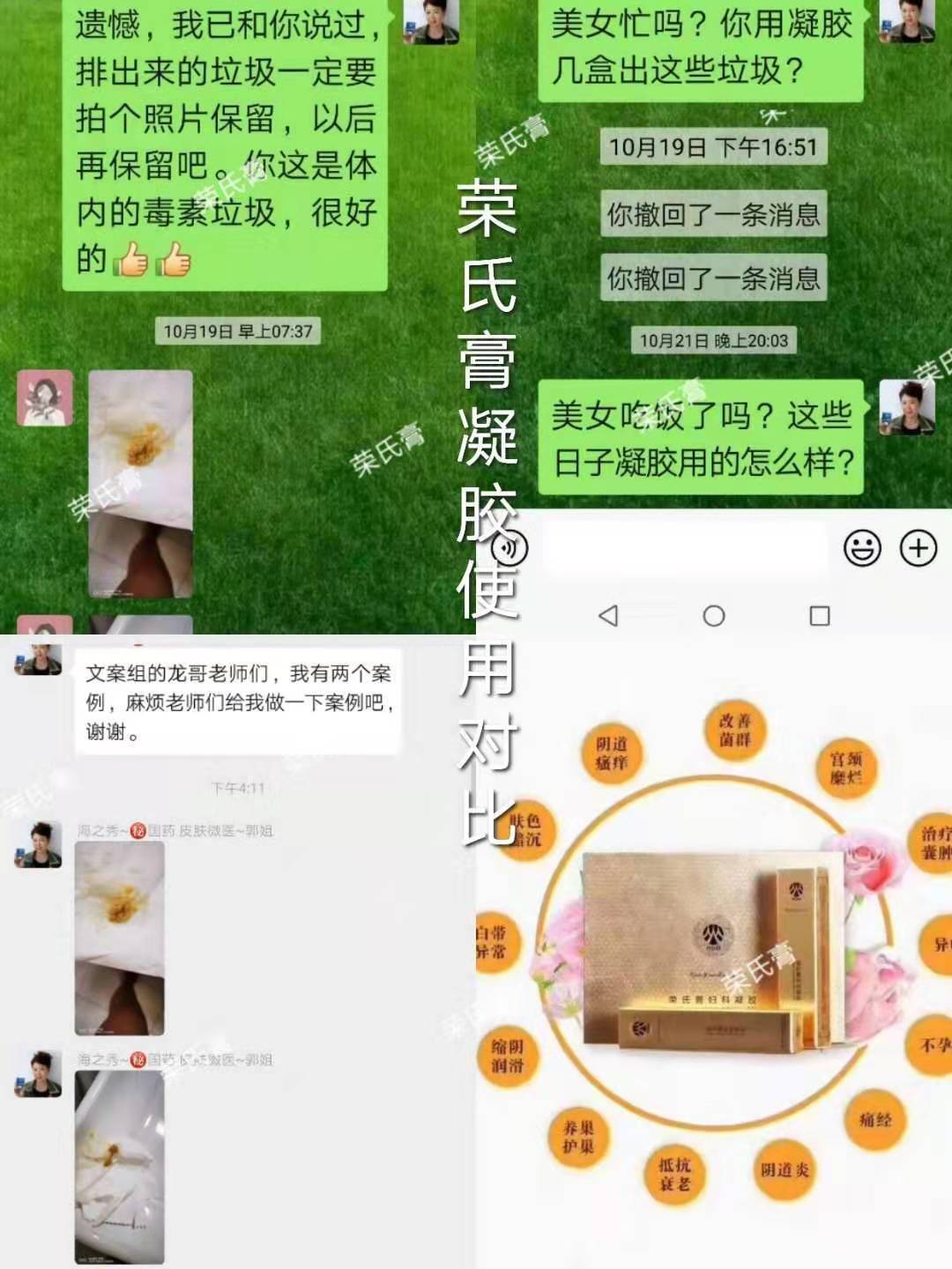 1583159536441052.jpg 凝胶反馈.jpg