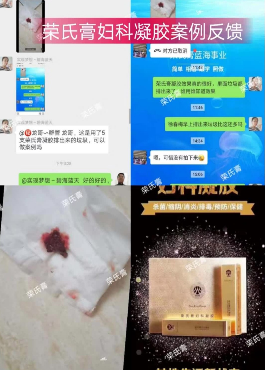 1583159699883424.jpg 凝胶反馈1.jpg