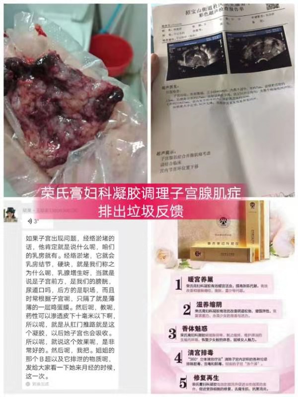 1583160177526252.jpg 子宫腺肌症反馈.jpg