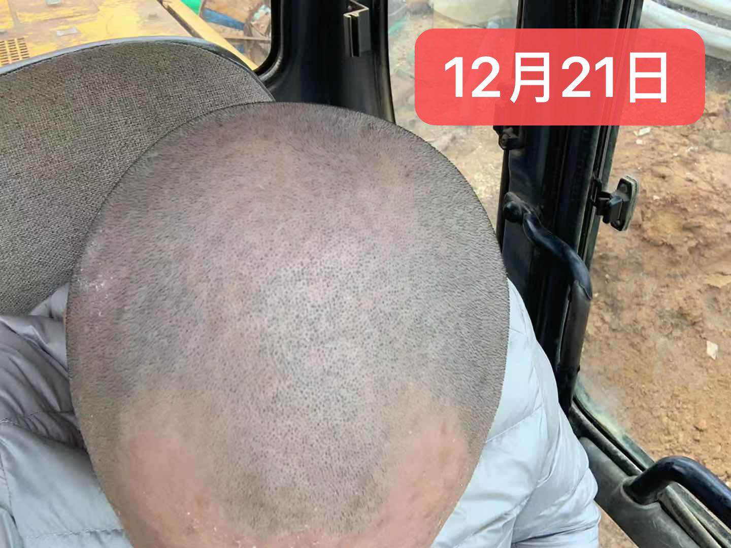 1583066421463533.jpg 6ac976e2c254c832ea1463729b43dc7.jpg