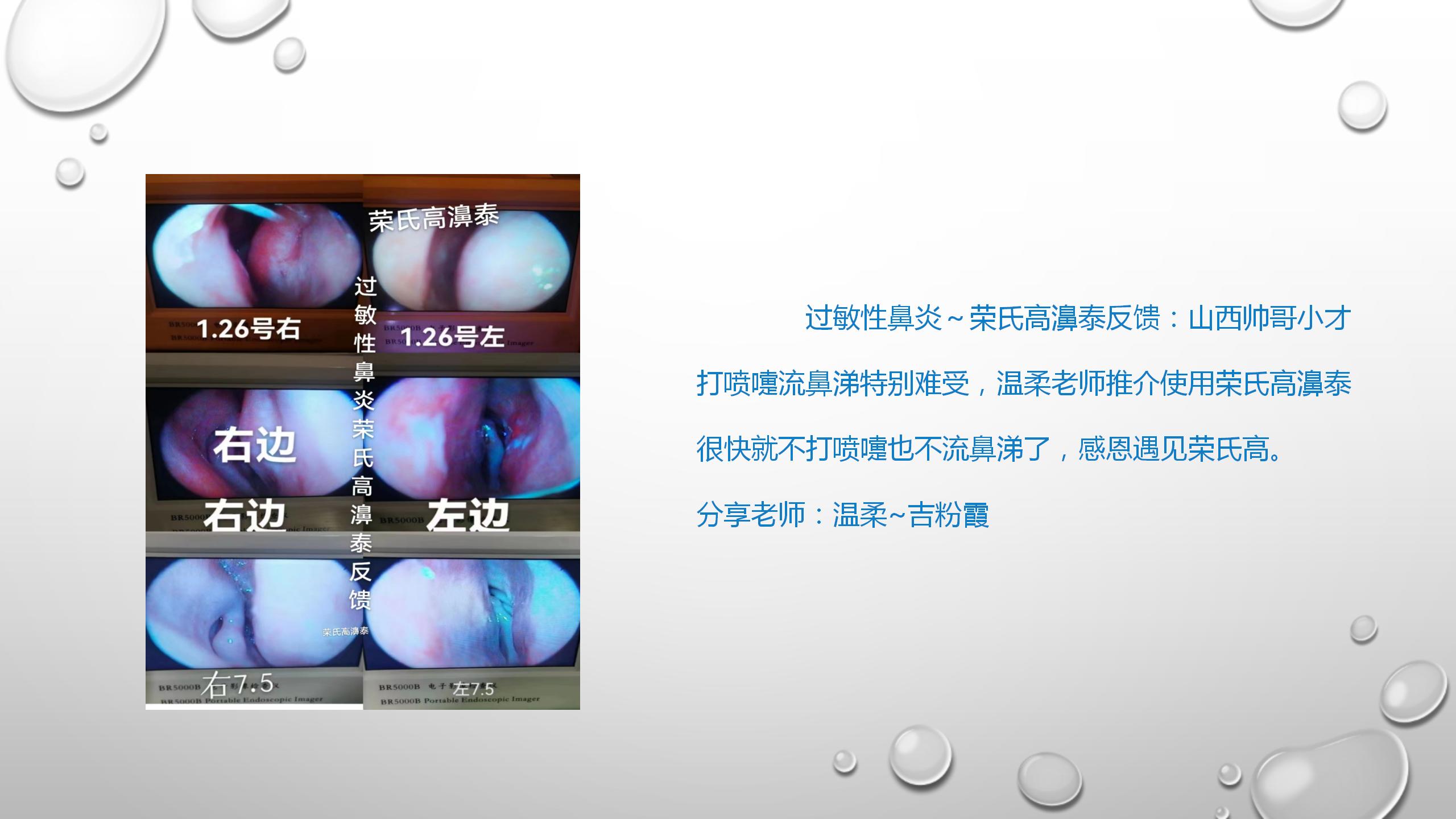 慢性鼻炎的特征与调理探讨(2)(1)_30.jpg