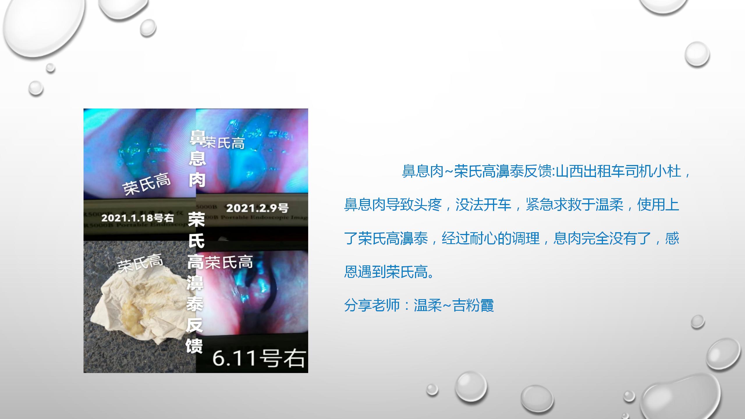 慢性鼻炎的特征与调理探讨(2)(1)_36.jpg